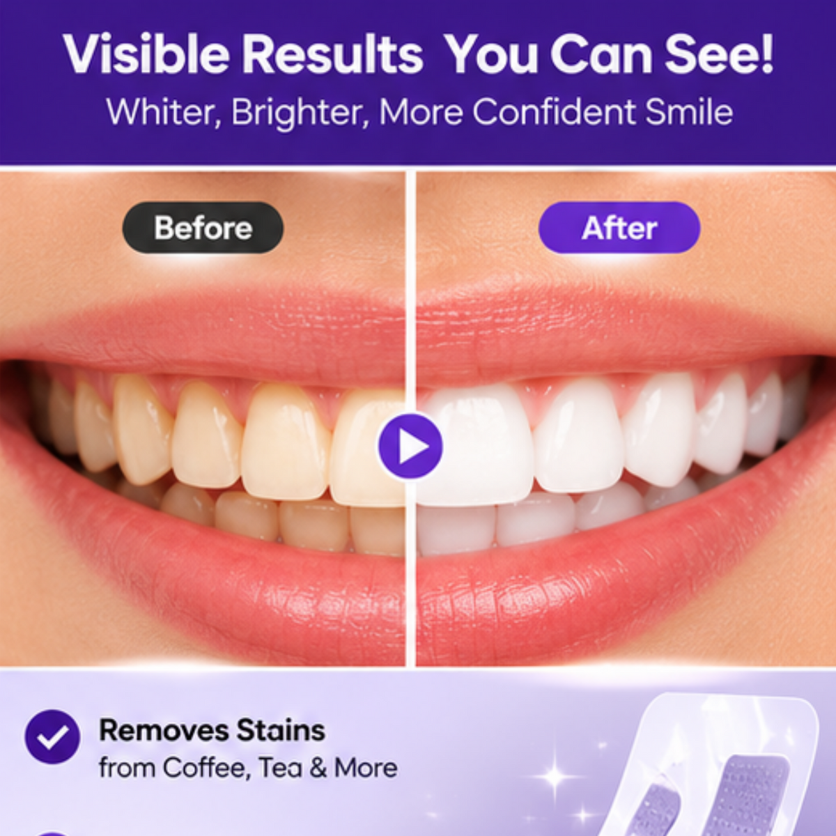 Teeth Whitening Strips